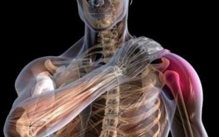 Что такое вывих плечевого сустава(плеча) и какие процедуры применяетбся для его лечения