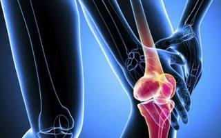 Хрустит колено: основные причины и симптомы состояния