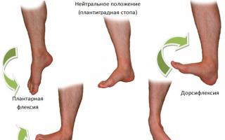 Métodos de diagnóstico y tratamiento para esguinces de pie.