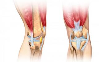 Чому болить під коліном ззаду при згинанні та розгинанні - що робити і як лікувати