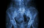 What tests should be taken for osteoporosis?